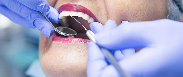 Best Emergency Broken Tooth Repair in Hamilton City, CA